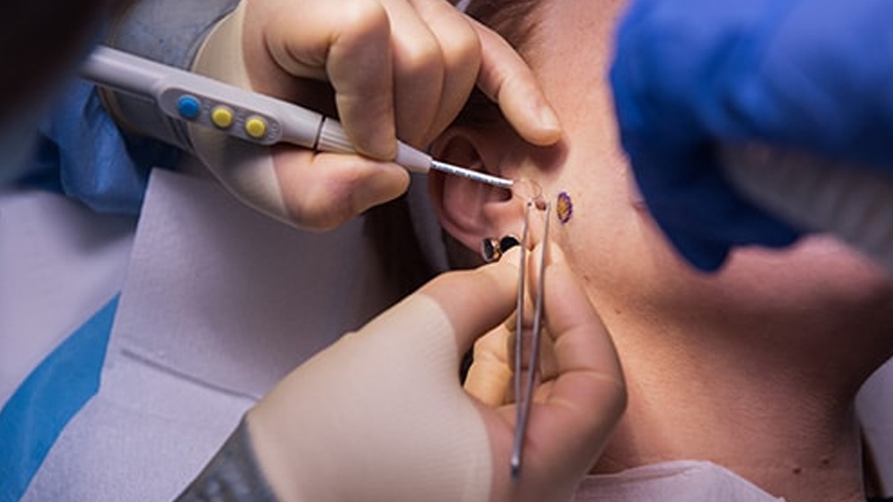 Minor Operation Theatres (Minor OTs)