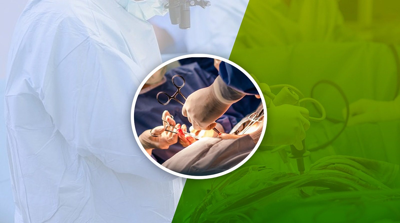 Vascular Surgery