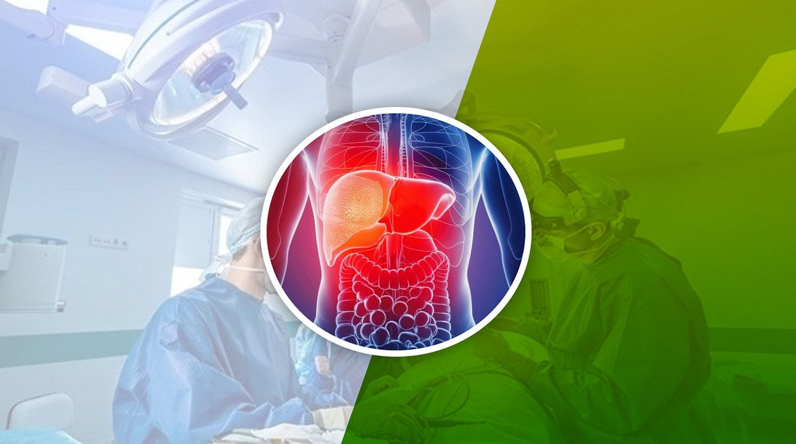 Hepatology and Liver Transplant