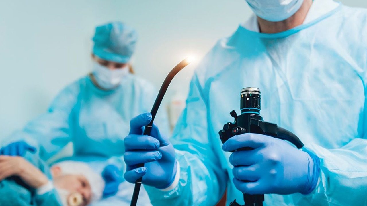 Endoscopy