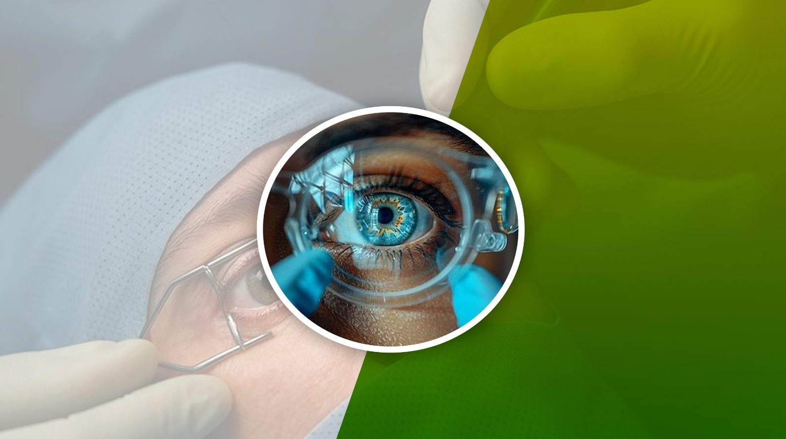 Ophthalmology